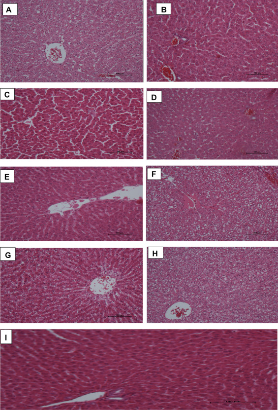 (A–I) Photomicrographs of liver sections stained with H & E. Note the normal ...