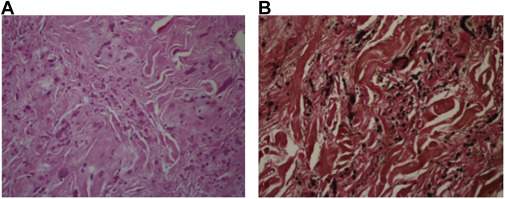 Fig. 4