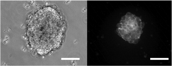 Sphere formation. Endothelial cells cultivated in medium with the addition of ...