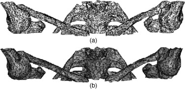 Estudio del hombro: a) isosuperficie no simplificada, b) isosuperficie ...