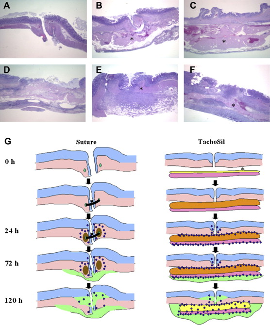 Histology of colorectal anastomoses treated with (A, D) circular sutures, (B, E) ...