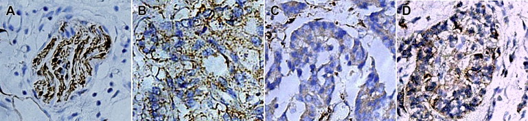 The representative images of immunochemistry (counterstained with hematoxylin). ...