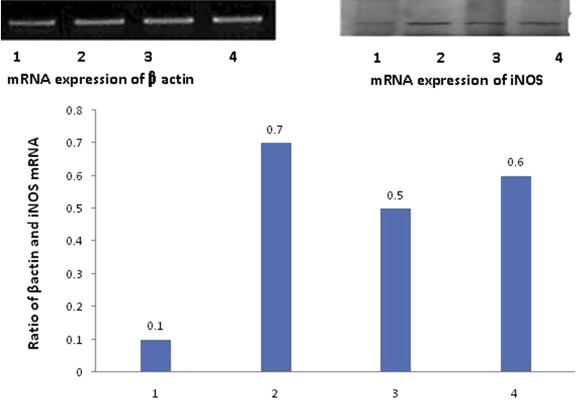 Expression of mRNA for iNOS by reverse transcriptase polymerase chain reaction ...