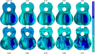 Deflexión normal de la tapa durante el segundo valle de la gráfica de ...