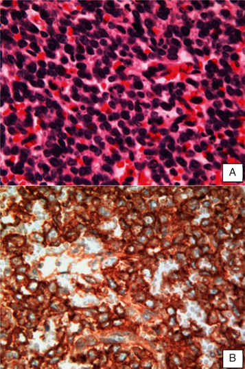 Imagem representativa da histologia de SE renal – A. 400x HE ‐ células de núcleo ...