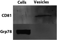 Western blot results. CD81 is present in extracellular vesicle (EV) (labeled ...