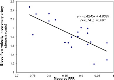 Correlation between FFR and FD-OCT derived blood flow velocity in coronary ...