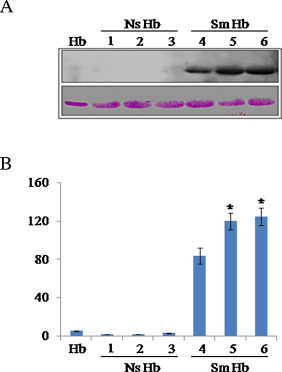 Representative immunoblots of pure Hb and Hb isolated from blood of smokers (Sm ...
