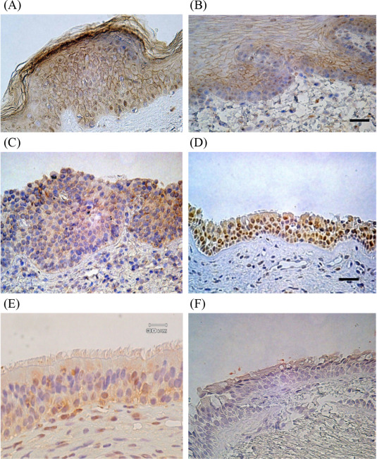 Immunohistochemical analysis of filaggrin was evaluated under a microscope at ...