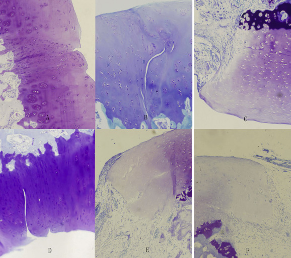 Histological findings of Toluidine blue 100×. A: Group Il. The cartilage and the ...