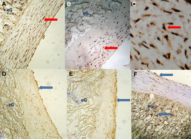 Inmmunohistochemistry staining indicates percentage of PCNA-positive cells of ...