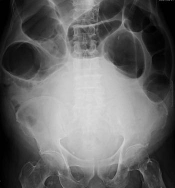 Kidney ureter bladder radiograph.