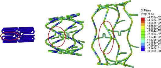 Apertura que sufre la celda durante el proceso de expansión del estent. ...