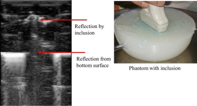 Ultrasound image of a phantom with inclusion captured in the prototype.