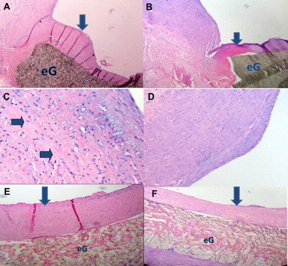 Histological sections of the ePTFE graft anastomosed to the subrenal aorta ...