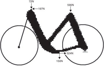 Topologia ótima obtida via SESO.