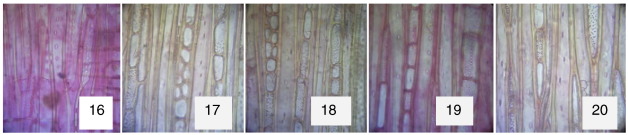 Radial longitudinal sections (×400). 16: Xylene-cleared. 17: Groundnut ...