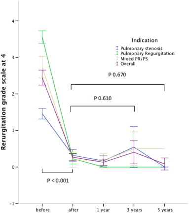 Evolution of pulmonary regurgitation before, immediately after implant and ...