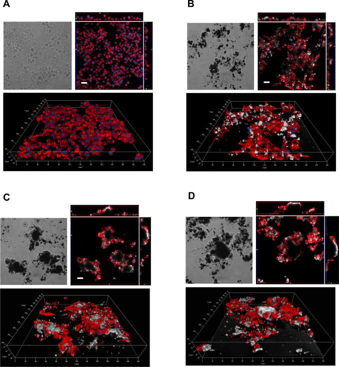 Contrast phase (top left) and confocal images (top right and bottom) of Raw264.7 ...