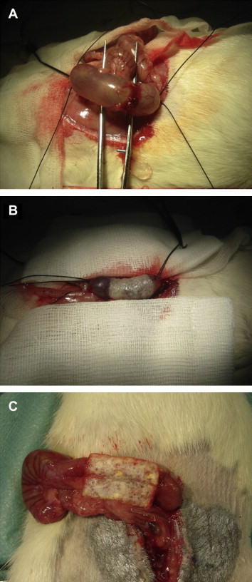Photographs of three different types of colorectal anastomosis performed in a ...