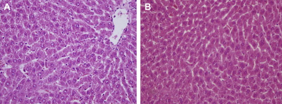 (A) Normal liver tissue histology of the S group; (B) clinoptilolite had caused ...