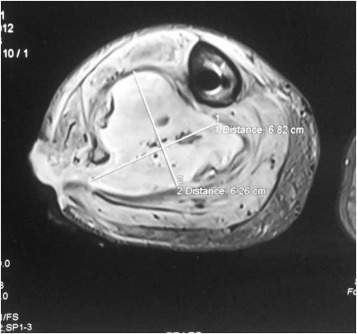 Fig. 7