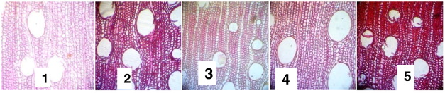 Transverse sections (×100). 1: Xylene-cleared. 2: Groundnut oil-cleared. 3: ...