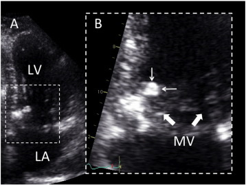 2D echocardiography of CAT (personal unpublished data).Echocardiographic four ...