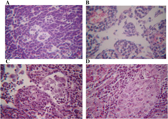 Structure of a mouse regional inguinal lymph node after injection of lithium ...