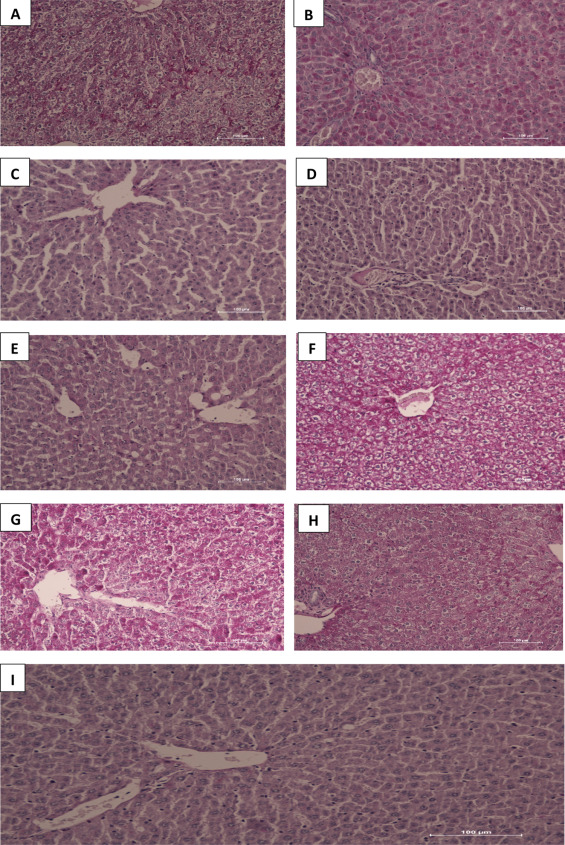 (A–I) Photomicrographs of liver sections stained with PAS. Note the intense pink ...