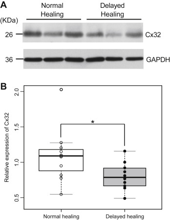 (A) Comparison of the expression of connexin 32 (Cx32) between the gastric ...