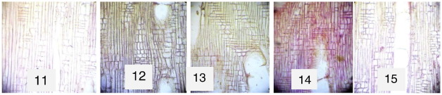 Radial longitudinal sections (×100). 11: Xylene-cleared. 12: Groundnut ...