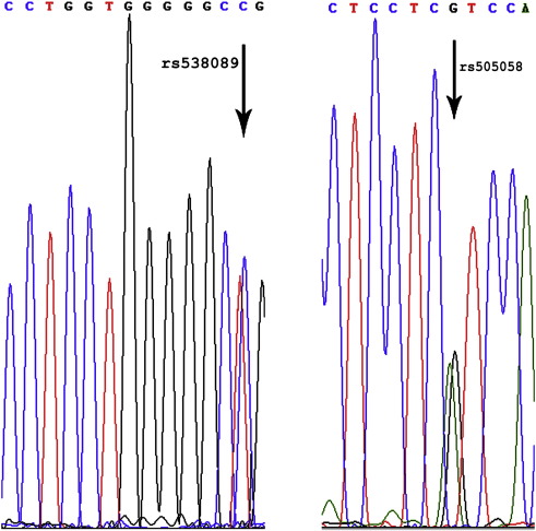 A representative chromatogram of 2 SNPs identified in DCM patients validated by ...