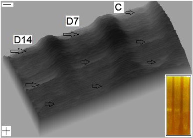 3-D surface view of the G6PD zymograms analysed using the Scion Imaging software ...