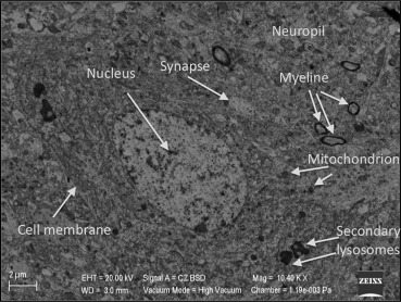 Electron microscopic view of the brain tissue in the sham group. All organelles ...