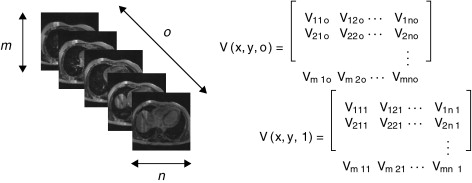 Representación tridimensional de una imagen médica, donde cada elemento Vx,y,z ...