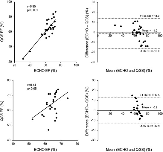 Correlation in left ventricular ejection fraction between echocardiography and ...