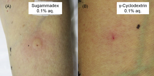 Responses to the intradermal test of sugammadex (0.1% aq.) (A) and ...