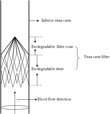 Schematic drawing of the biodegradable vena cava filter deployed in the vena ...