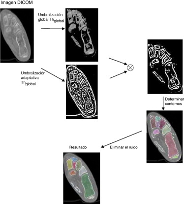 Algoritmo de segmentación propuesto.