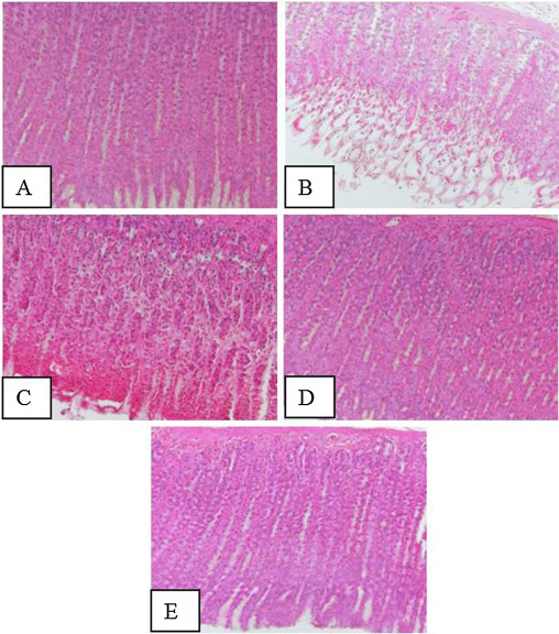 Effect of vanilllin on ethanol induced histological changes of gastric tissue. ...