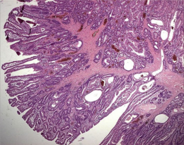 Arborizing framework of smooth muscle within the muscularis mucosae.