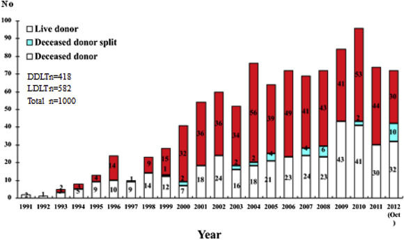 The first 1000 liver transplants at Queen Mary Hospital, the teaching hospital ...