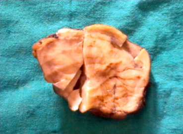 Cut surface of gross specimen, which is pale yellow and homogeneous.