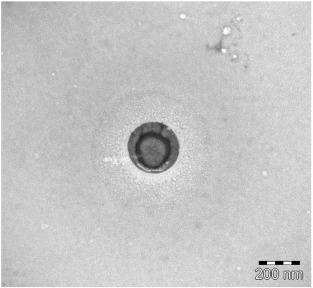 Electron microscopy picture of isolated extracellular vesicle. Note the ...