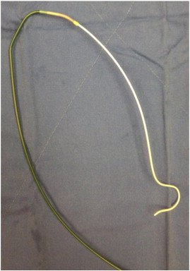 A 7 Fr Kimny guiding catheter (Boston Scientific, Grove, MN, USA) was loaded by ...