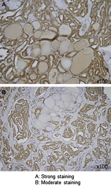 Severity scores of Mullerian inhibiting substance staining under a light ...