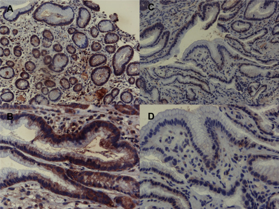 Immunohistochemical analysis of connexin 32 in the gastric mucosa of the normal ...