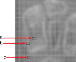 Imagen ampliada de TC del pie. a) Región de píxeles que representan el tejido ...