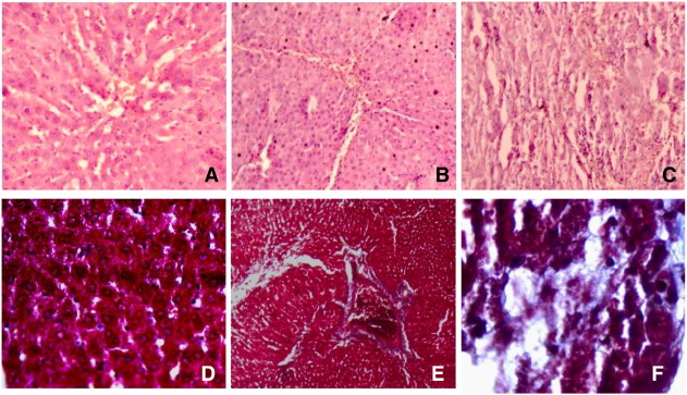 Photomicrographs of liver specimens stained with H&E (A–C) and Masson' ...